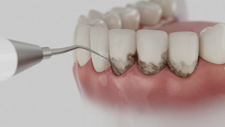 Reliable Root Canal Treatment contractor in Marshall County County, OK by Dentist Open Now